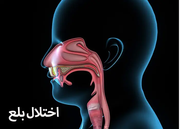 بهترین درمان های طبیعی برای اختلال بلع