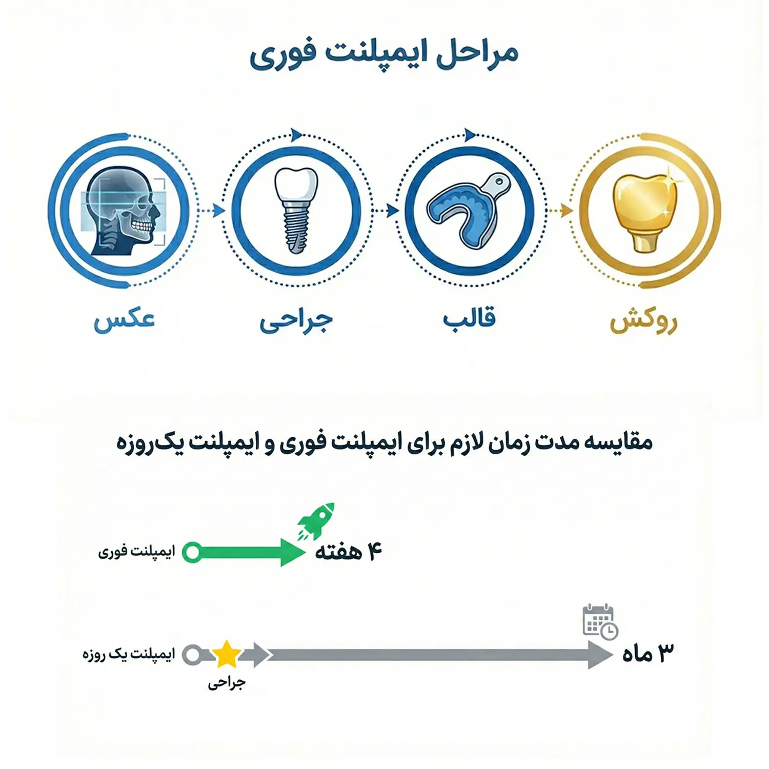 ایمپلنت فوری چیست؟ ایمپلنت یک‌روزه چیست؟ چه تفاوتی دارند؟ IINSTANT IMPLANT