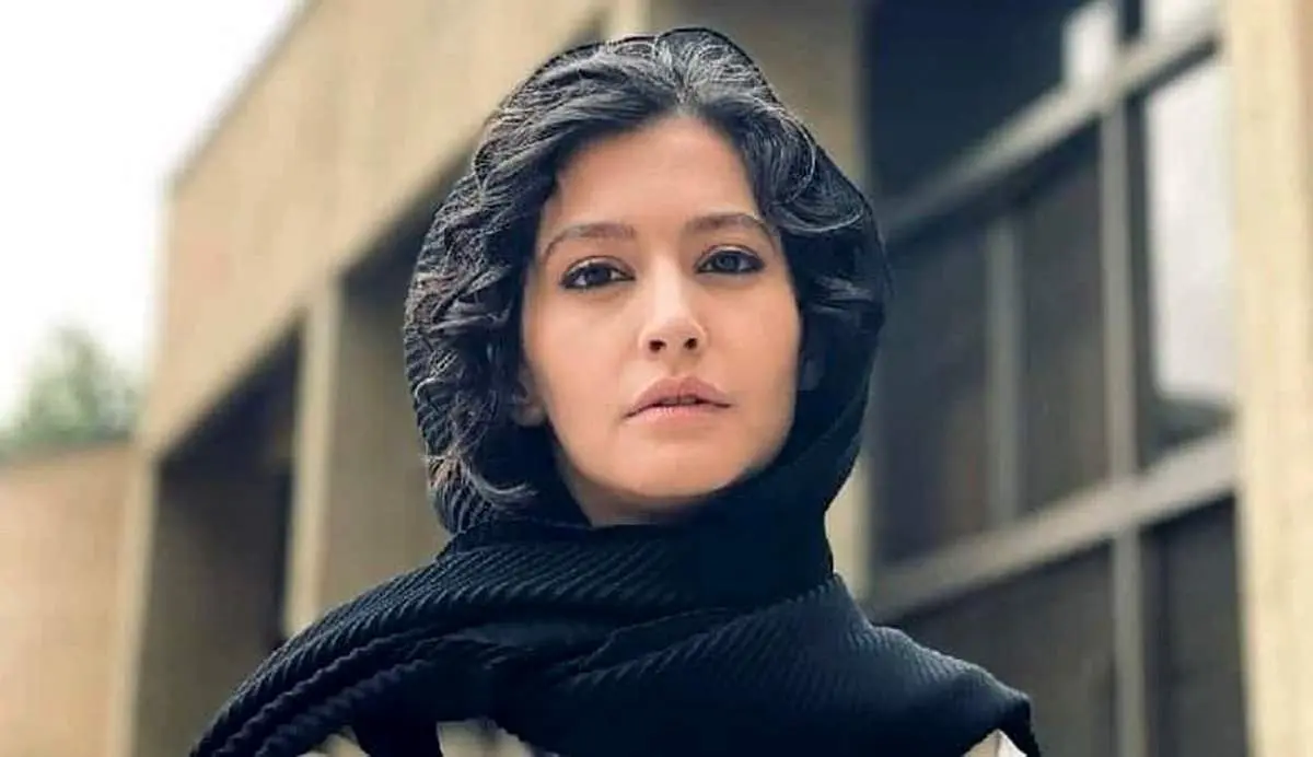 بازیگر پوست شیر دچار سانحه شد/ عکس