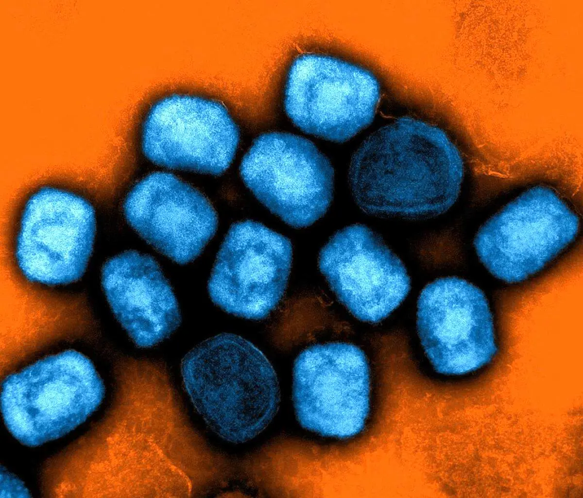 هشدار درباره شیوع انسانی آبله میمون