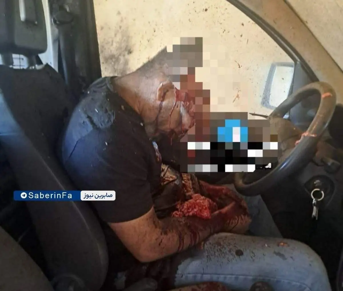 تصویری دلخراش از یک شهید در انفجارهای امروز لبنان / حاوی محتوای ناراحتکننده