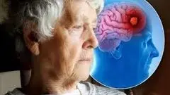 هشدار علمی: آسیب خاموش قلب در میانسالی، عامل پنهان زوال عقل در سالمندی