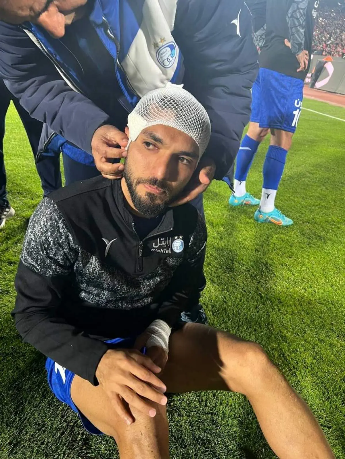 هواداران پرسپولیس ، بازیکن استقلال را مصدوم کردند 