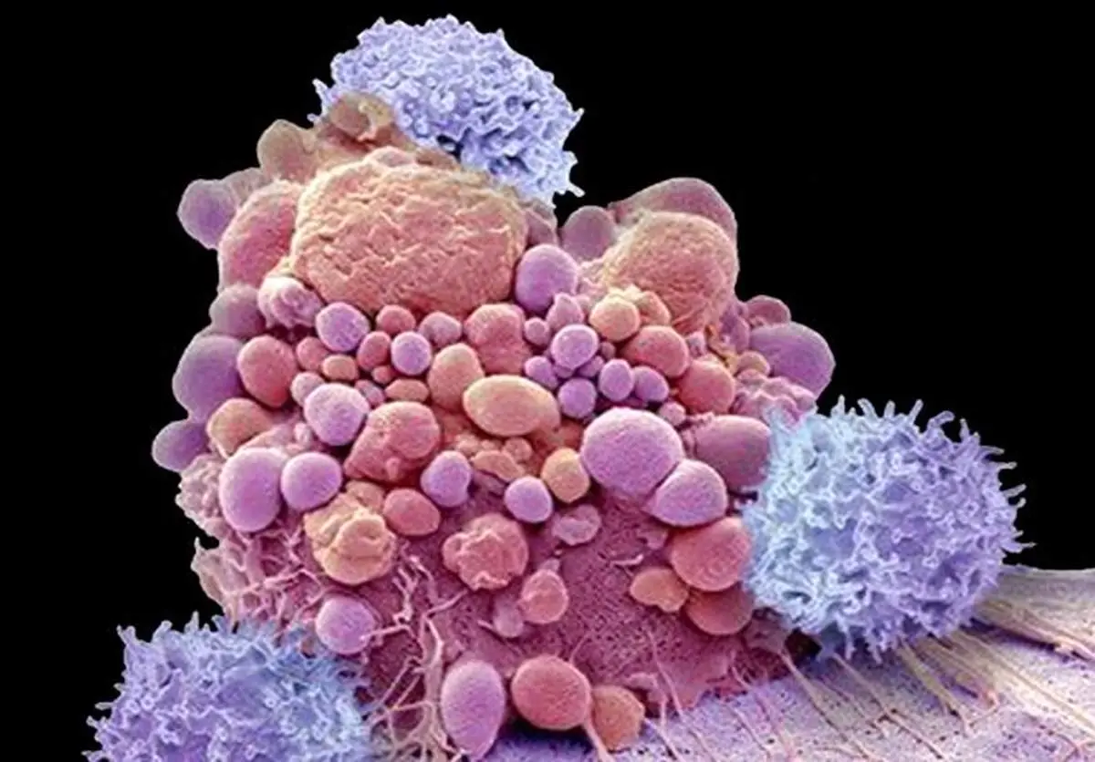 این ماده غذایی خواص ضد سرطان دارد