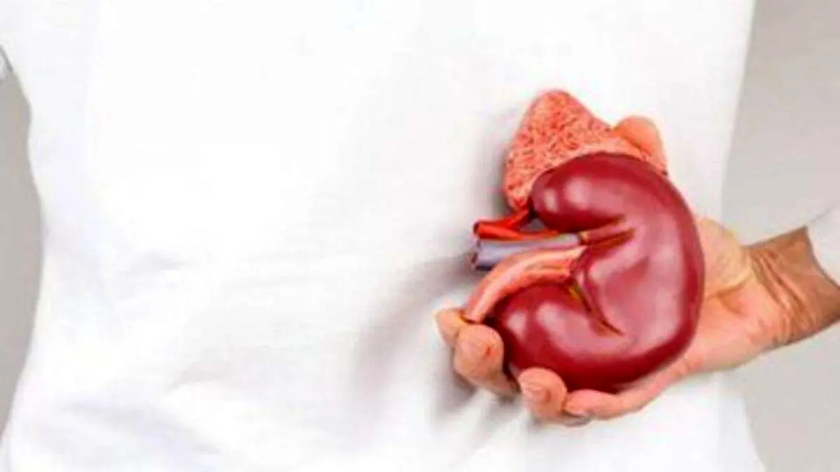 توصیههای غذایی برای پیشگیری و مدیریت سنگ کلیه