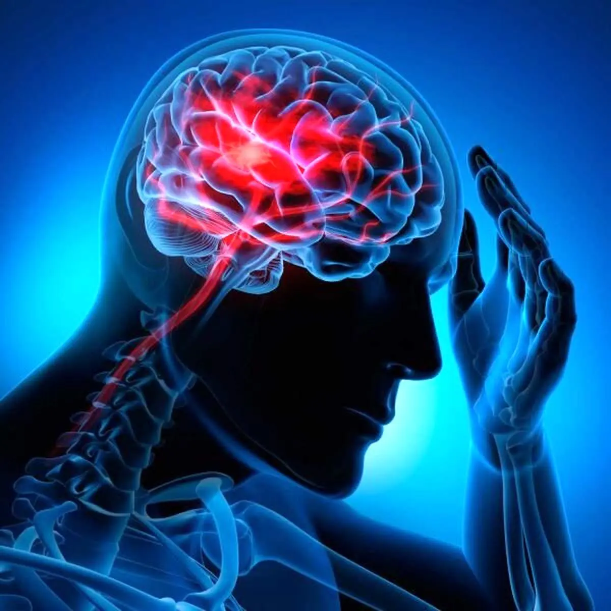 چه درمانهایی برای سکته مغزی مناسب هستند؟