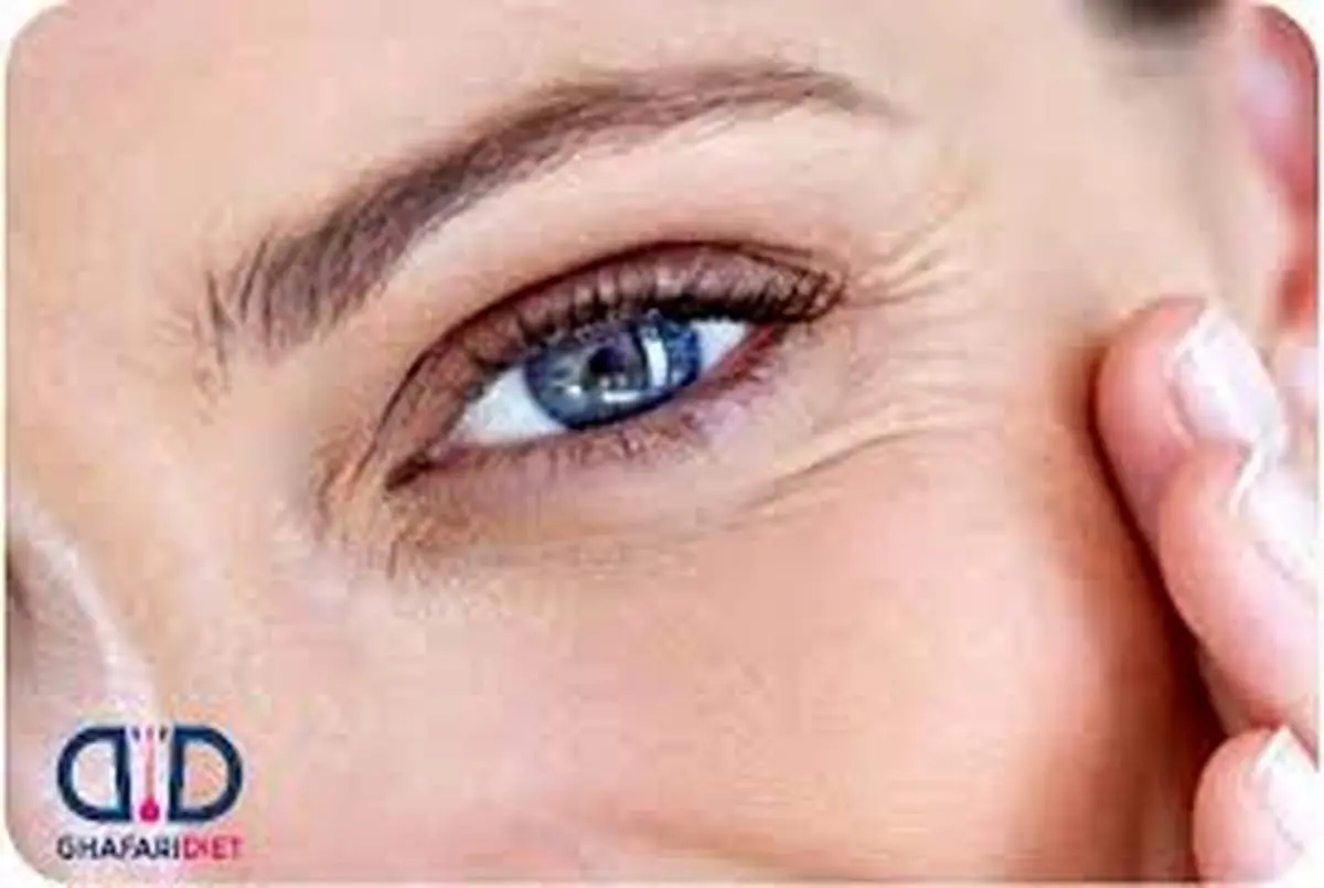این میوه سبب افزایش بینایی میشود