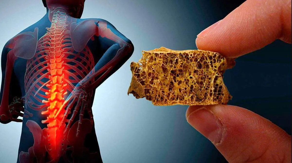 خوراکیهایی که از پوکی استخوان جلوگیری میکند