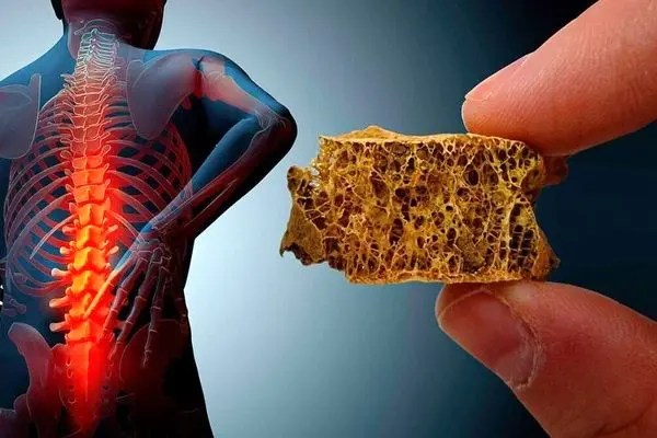 خوراکی‌هایی که از پوکی استخوان جلوگیری می‌کند 