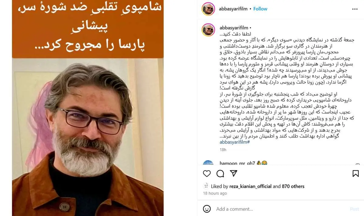 شامپوی تقلبی برای «پارسا پیروزفر» دردسر ساز شد/ عکس