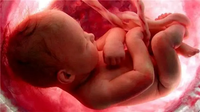 با طرح جدید مجلس درباره سقط جنین،"۷۰ هزار ناهنجاری" گریبان مردم را خواهد گرفت
