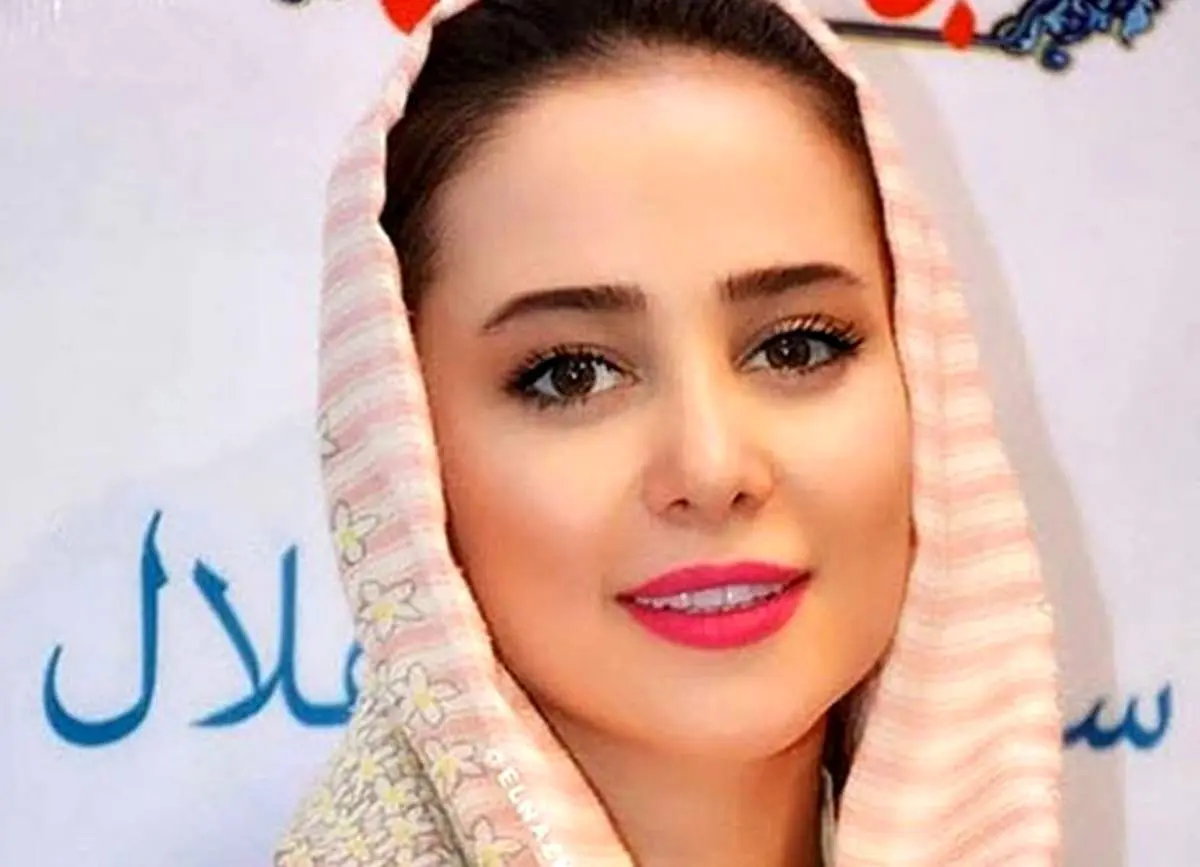 عکس دیده‌نشده الناز حبیبی قبل از جراحی‌های زیبایی!