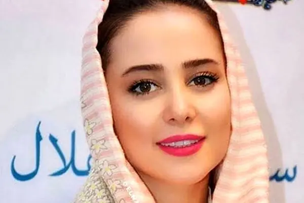 عکس دیده‌نشده الناز حبیبی قبل از جراحی‌های زیبایی!