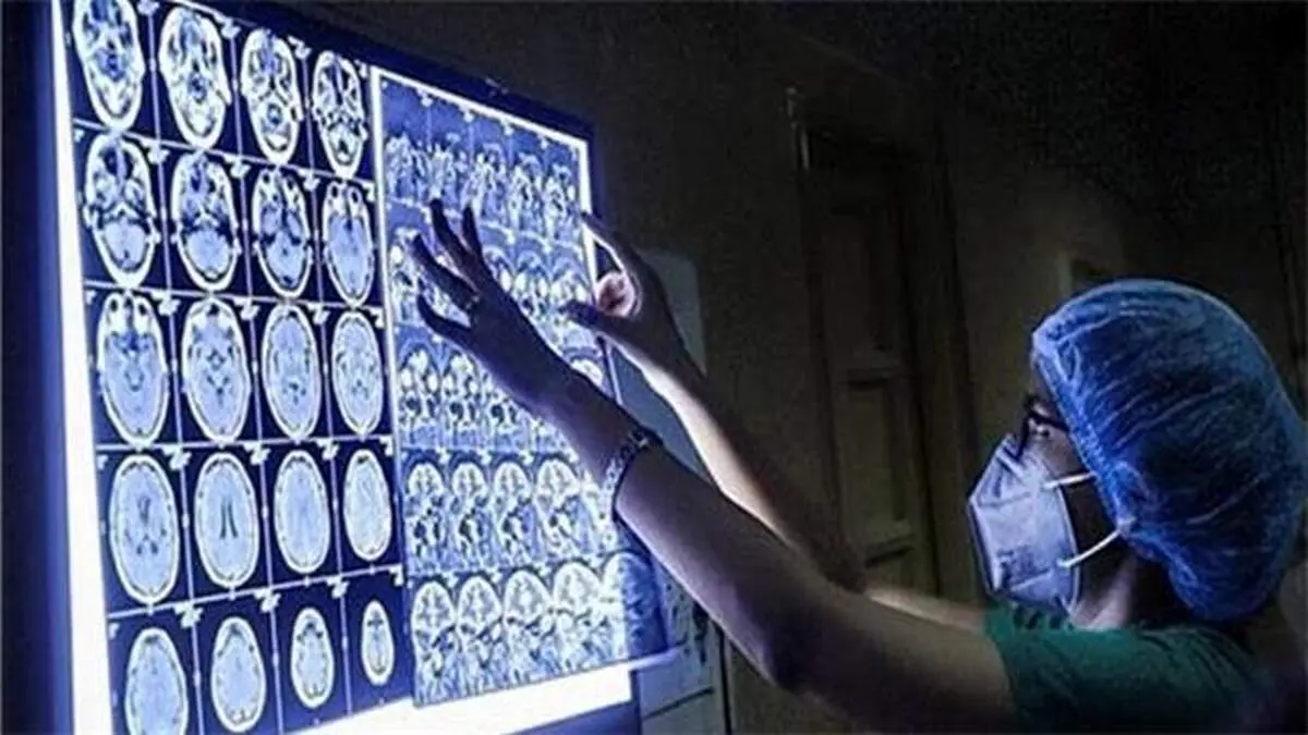 بیماری قارچ سیاه چیست؟