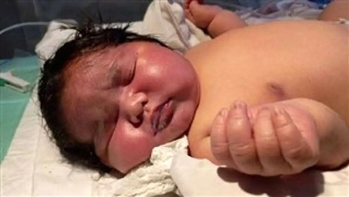 تسنیم از تولد یک نوزاد 7 کیلویی در پرتو عنایت امام رضا(ع) خبر داد