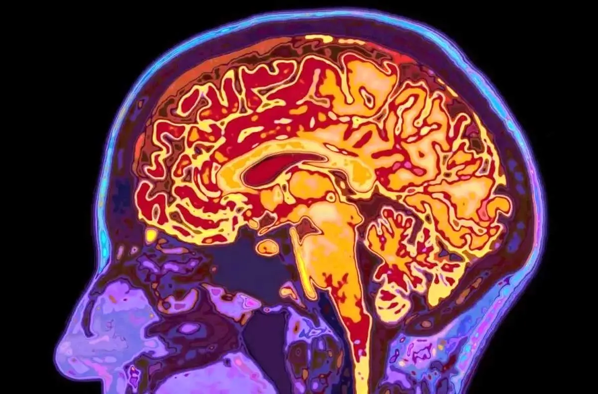 مغز انسان تا ۳۲ سالگی کامل نمی‌شود!