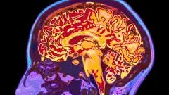 مغز انسان تا ۳۲ سالگی کامل نمی‌شود!