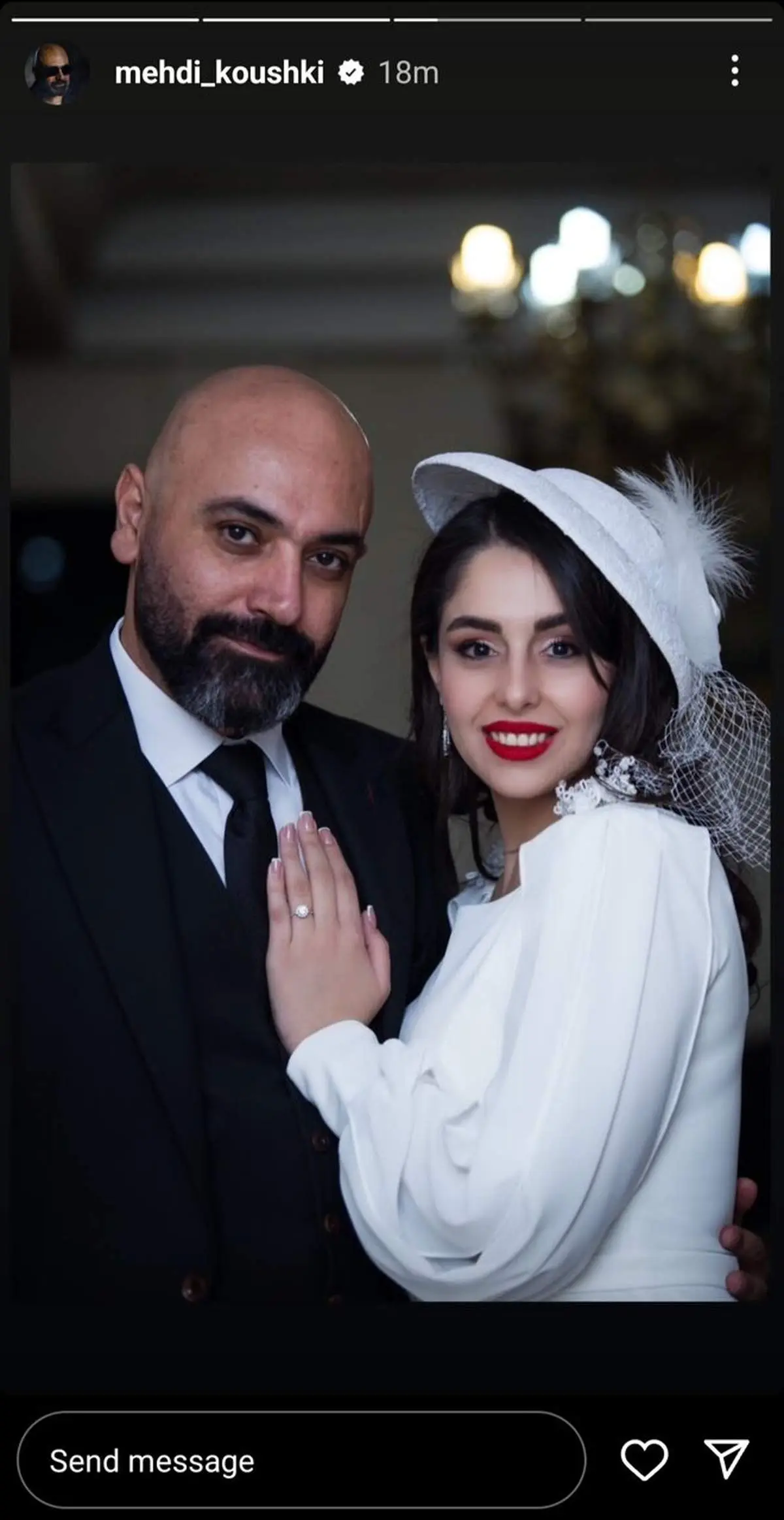  مهدی کوشکی و همسر جدیدش در ماه عسل!/ فیلم