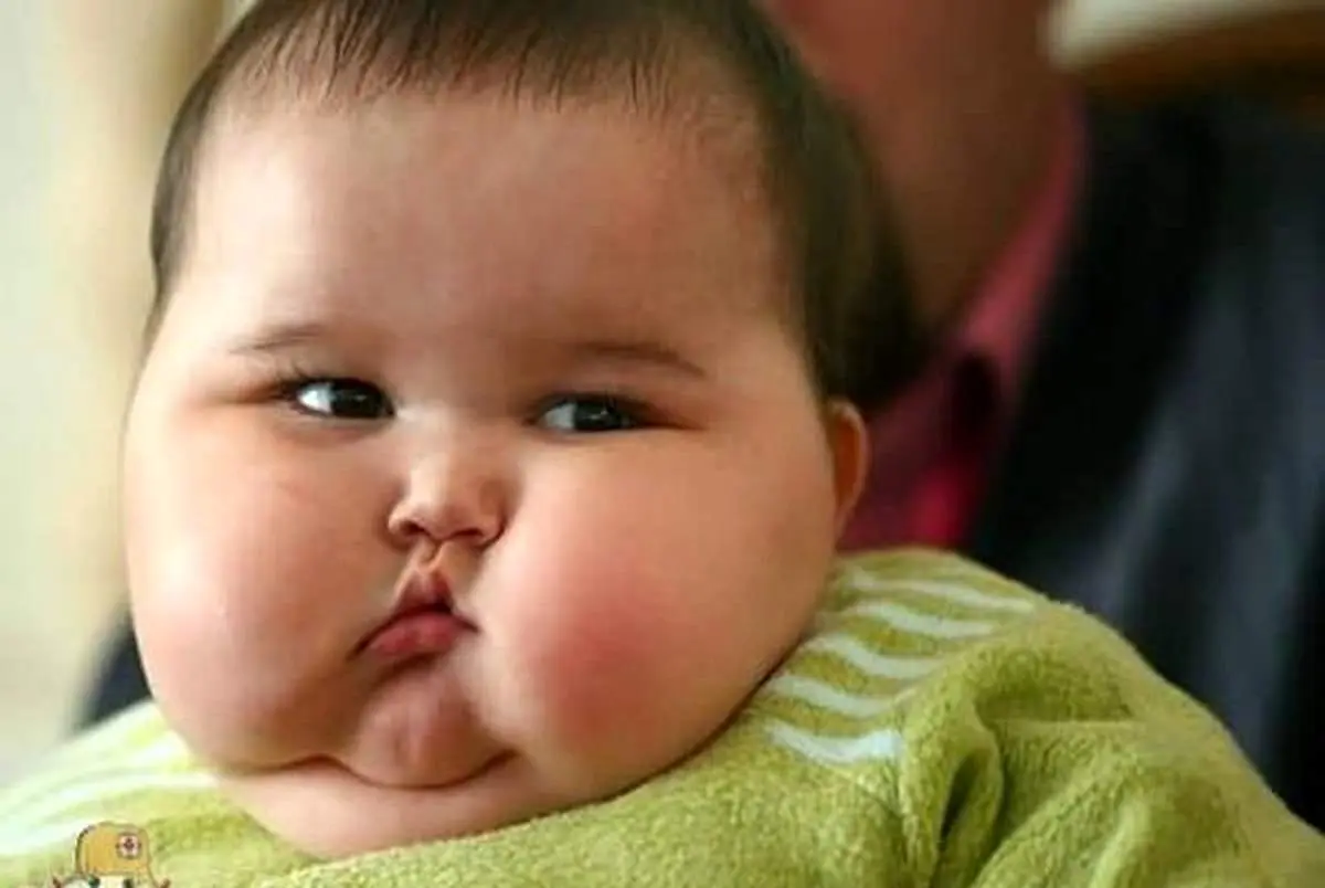 آیا چاقی ارثی است؟