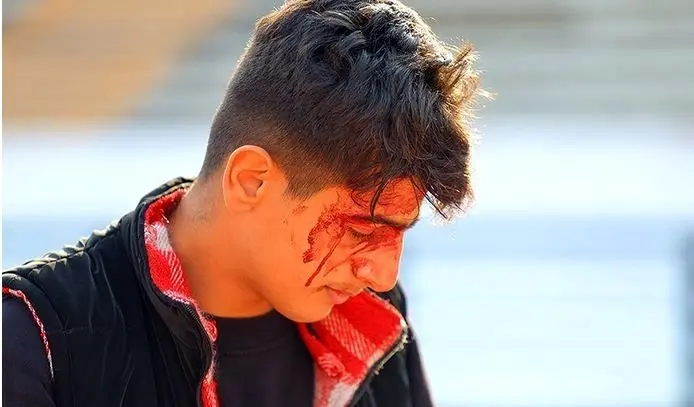 هواداران پرسپولیس با نقص عضو دائمی مواجه شدند
