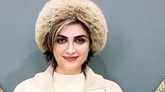 الناز ملک بعد از زخمکاری بد تیپ شد!/ عکس