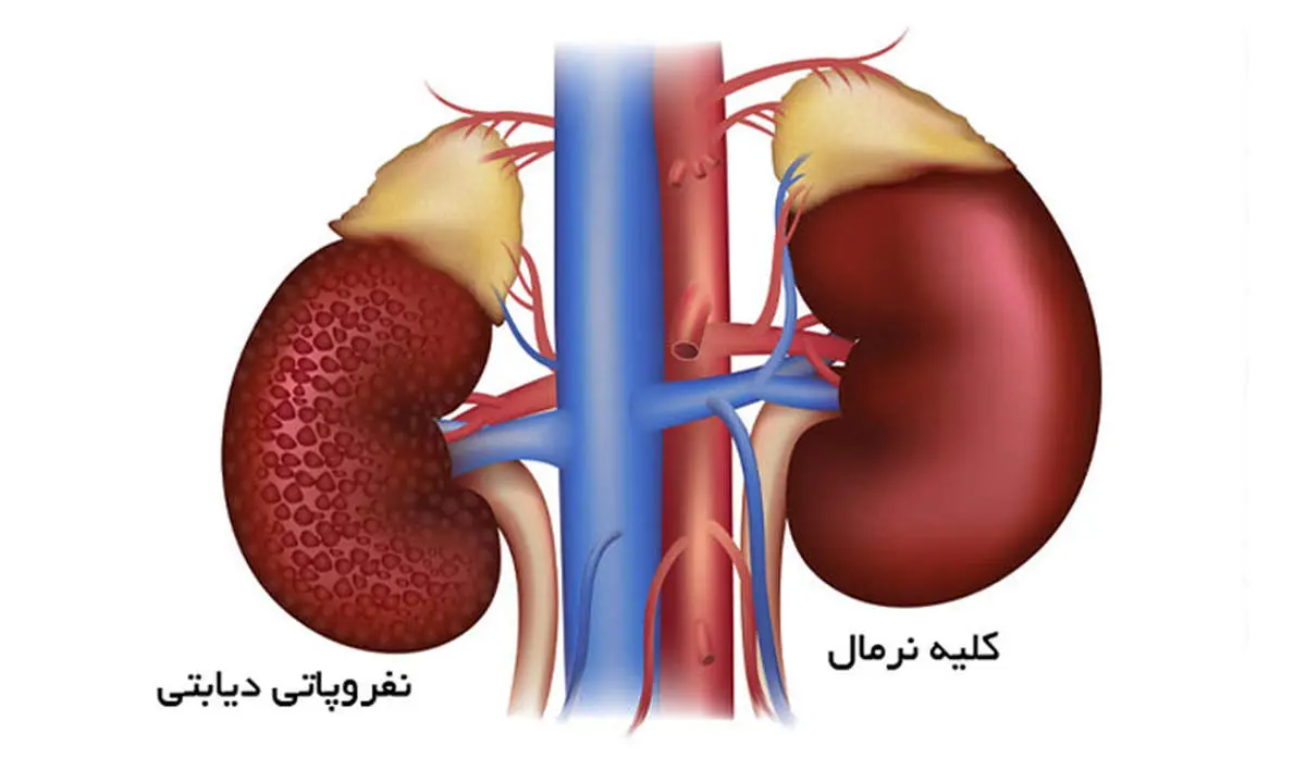 کمردرد شدید نشانه این بیماری جدی است