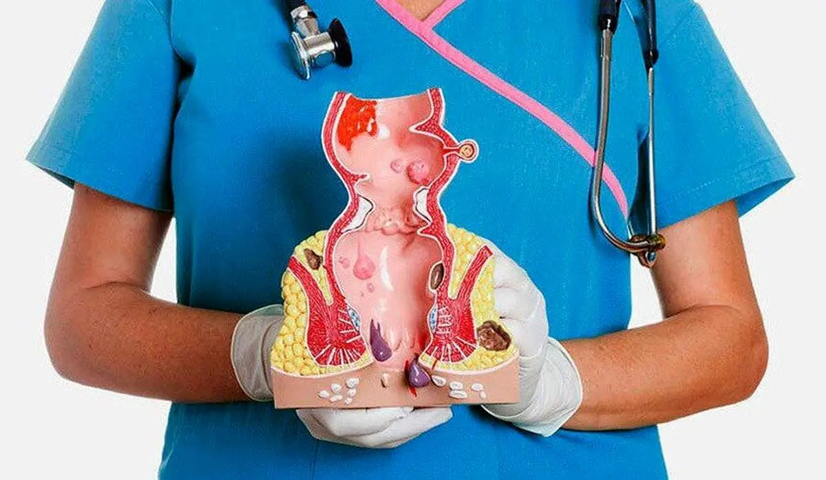 داروهای موقتی و درمان فوری بواسیر/ این غذاها بواسیر را تشدید میکنند