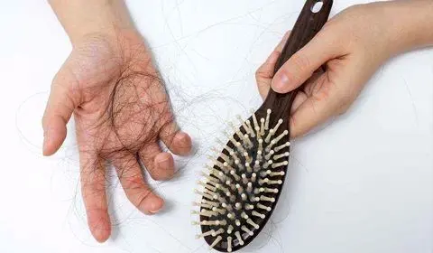 دلیل ریزش مو چیست؟