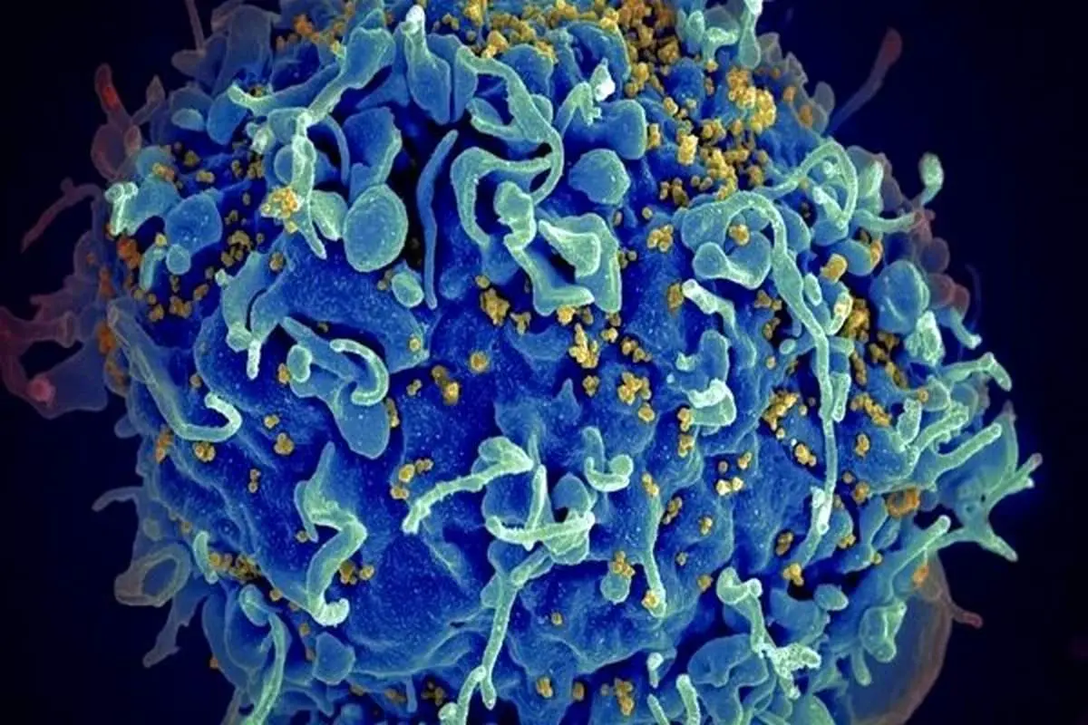 جنگافزار جدید برای مقابله با HIV ساخته شد