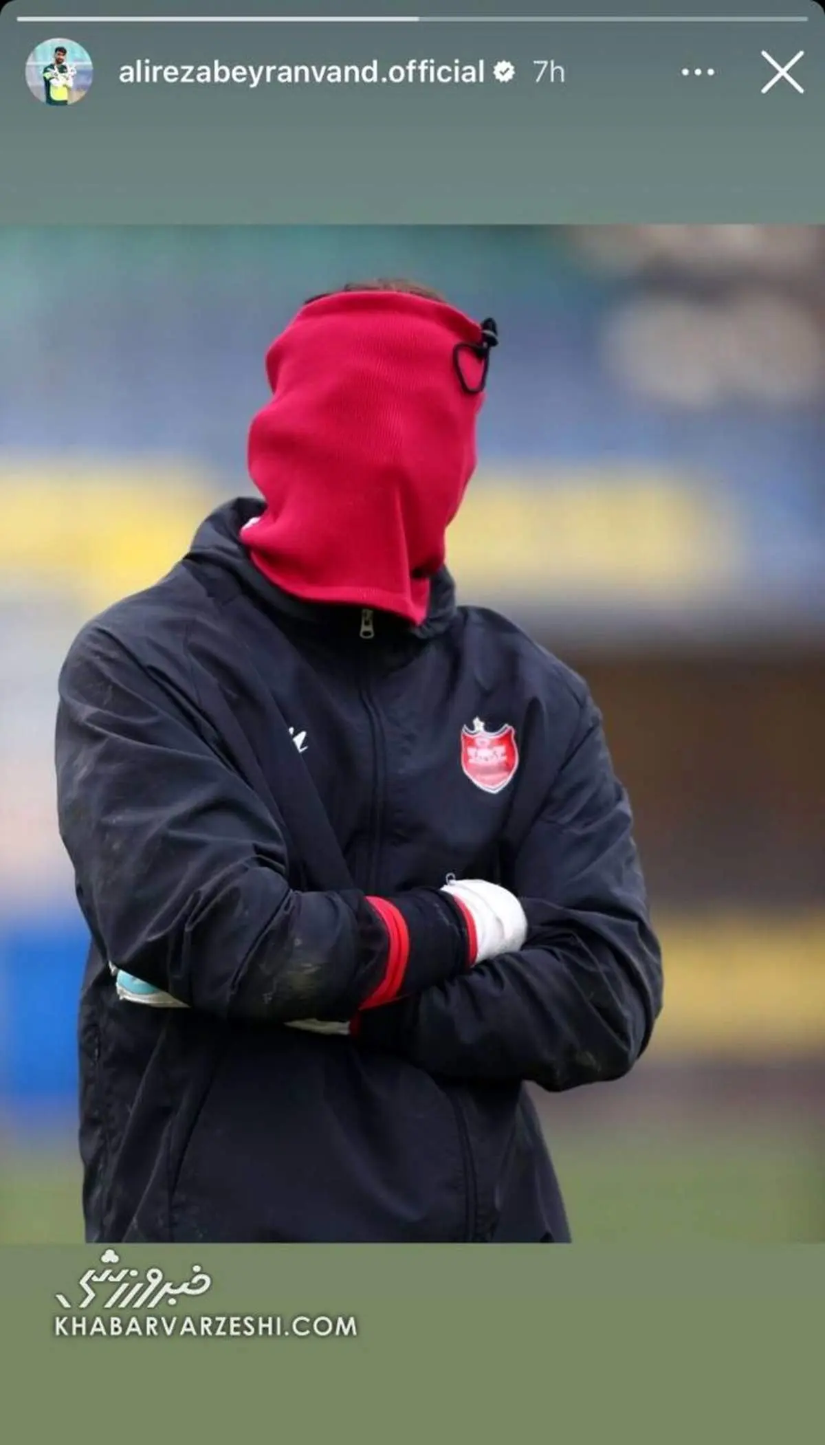 چهره ترسناک بیرانوند را ببینید 