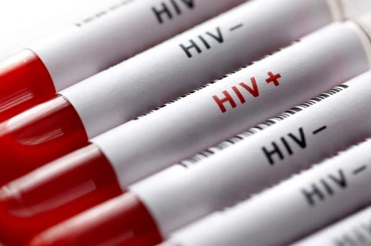 افسردگی شایعترین اختلال روانپزشکی در بیماران مبتلا به HIV