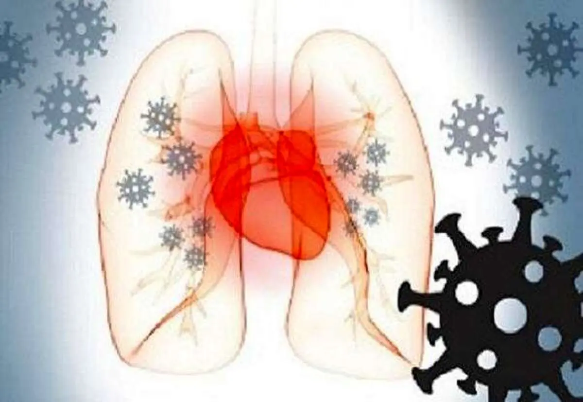 سکته قلبی در کمین بیماران کرونا/ تا یکسال خطر وجود دارد! 