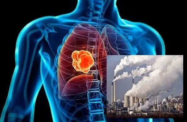 ارتباط هوای آلوده با سرطان ریه!