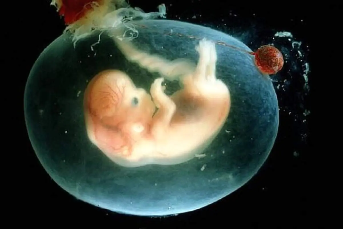 سن مجاز برای سقط جنین چقدر است؟ | صدور دستورالعمل جدید برای سقط جنین