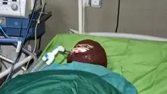 اسیدپاشی هولناک روی پدر و دختر