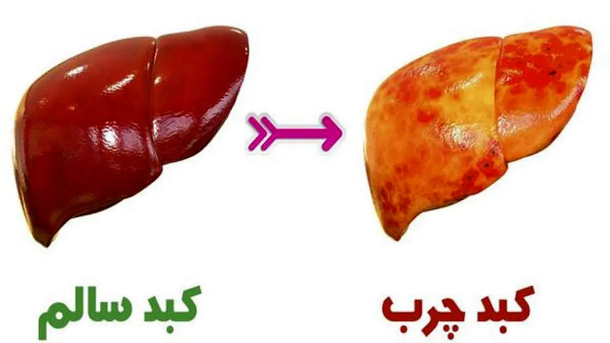 کبد سالم میخواهید از خوردن این مواد غذایی غافل نشوید