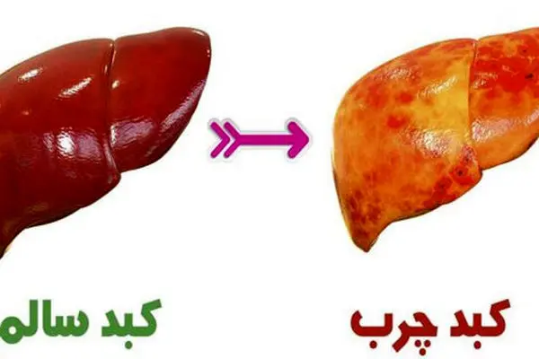 کبد سالم می‌خواهید از خوردن این مواد غذایی غافل نشوید