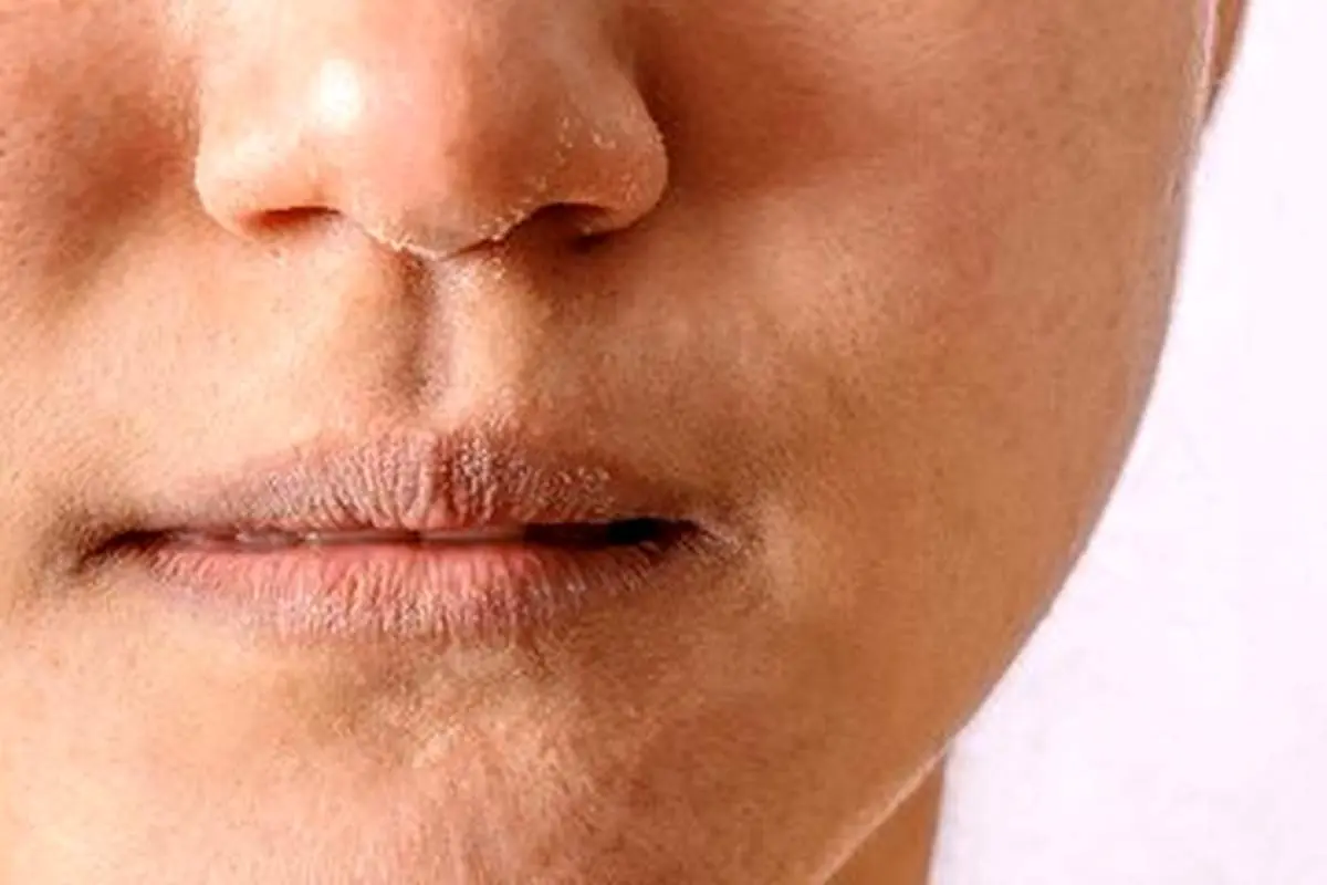 این گروه در سنین پایین پیر میشوند