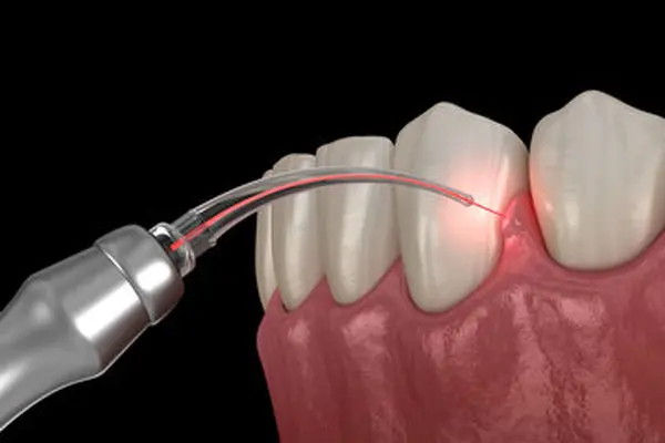  استرس بر سلامت دهان و دندان چه تاثیری دارد؟