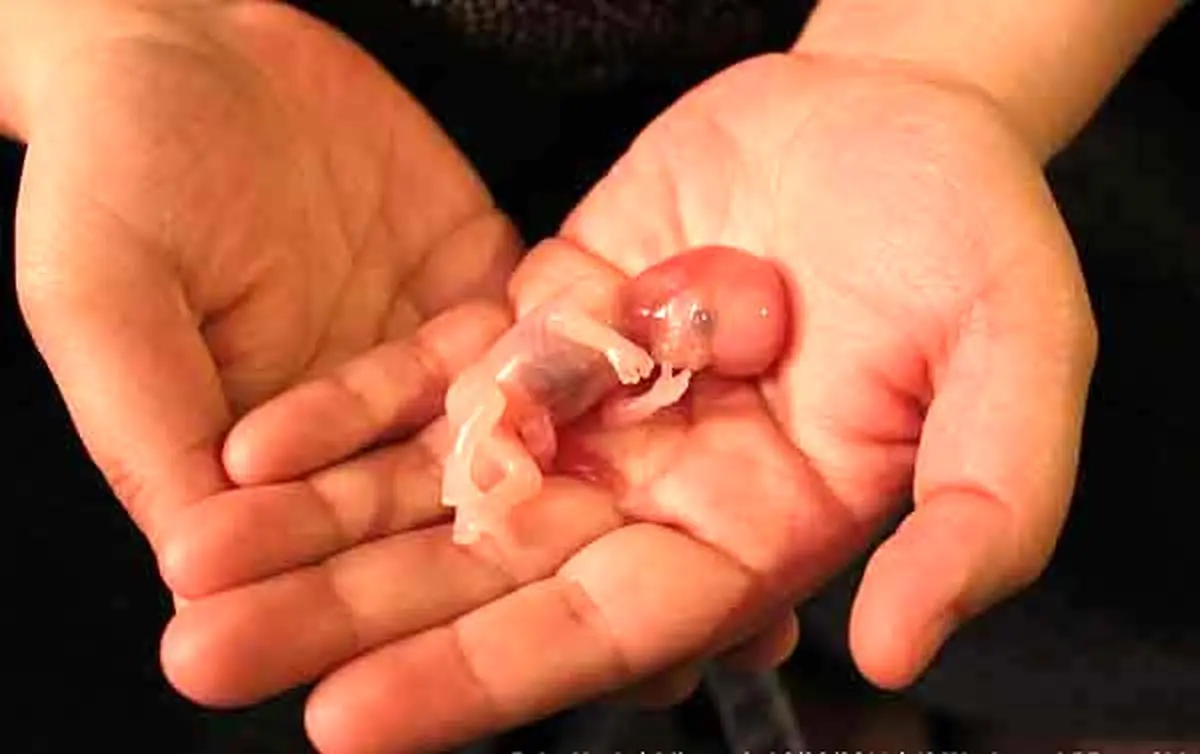 ببینید/ به چه افرادی مجوز سقط جنین داده می‌شود؟ 