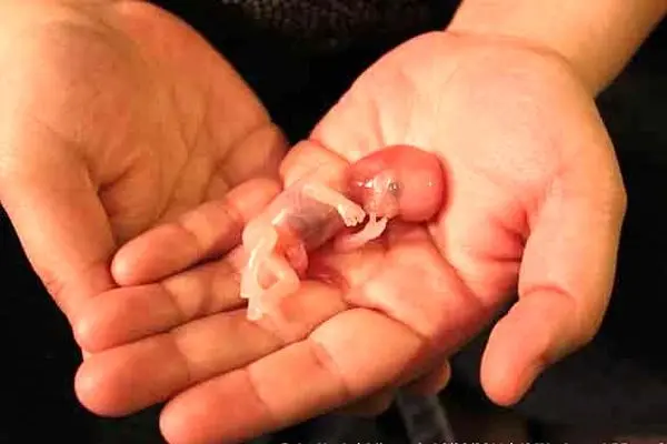 ببینید/ به چه افرادی مجوز سقط جنین داده می‌شود؟ 