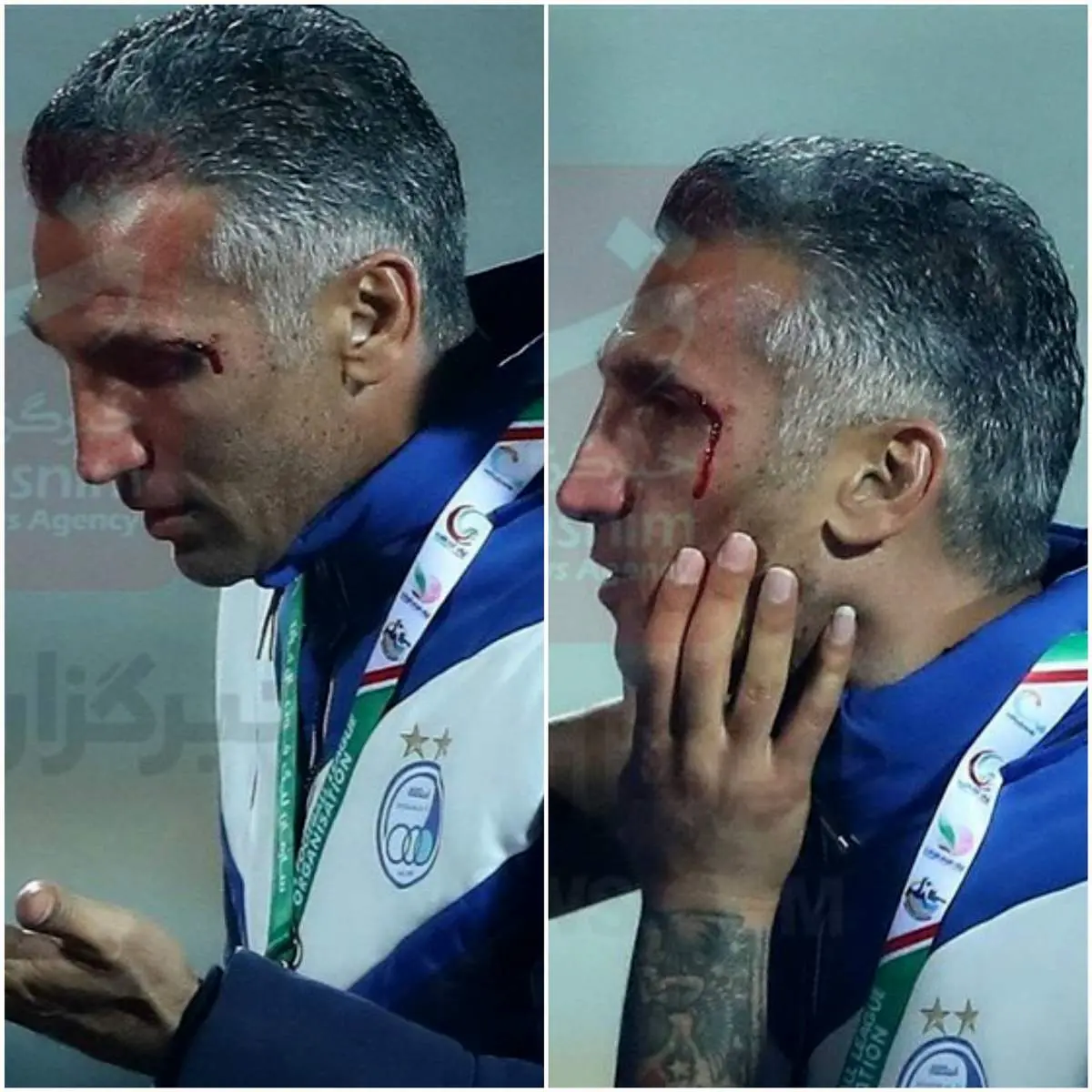 جریمه سر خونین هاشمی نسب چه میشود؟/ تصویر 