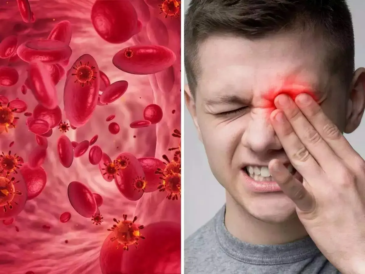 درمان کم خونی با شکلات تلخ و ۹ خوراکی دیگر 