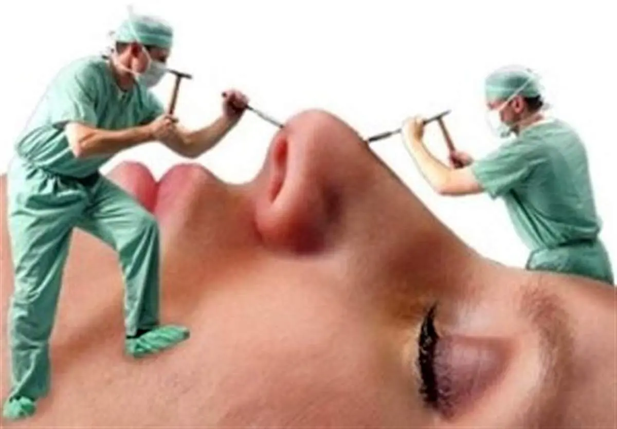 افزایش مرگ زنان زیر تیغ این جراحی های زیبایی