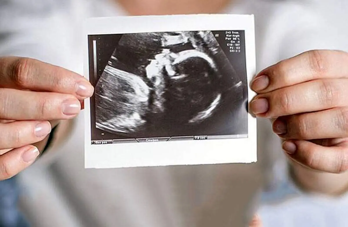 روشهایی نوین از طب سنتی برای افزایش باروری زوجین