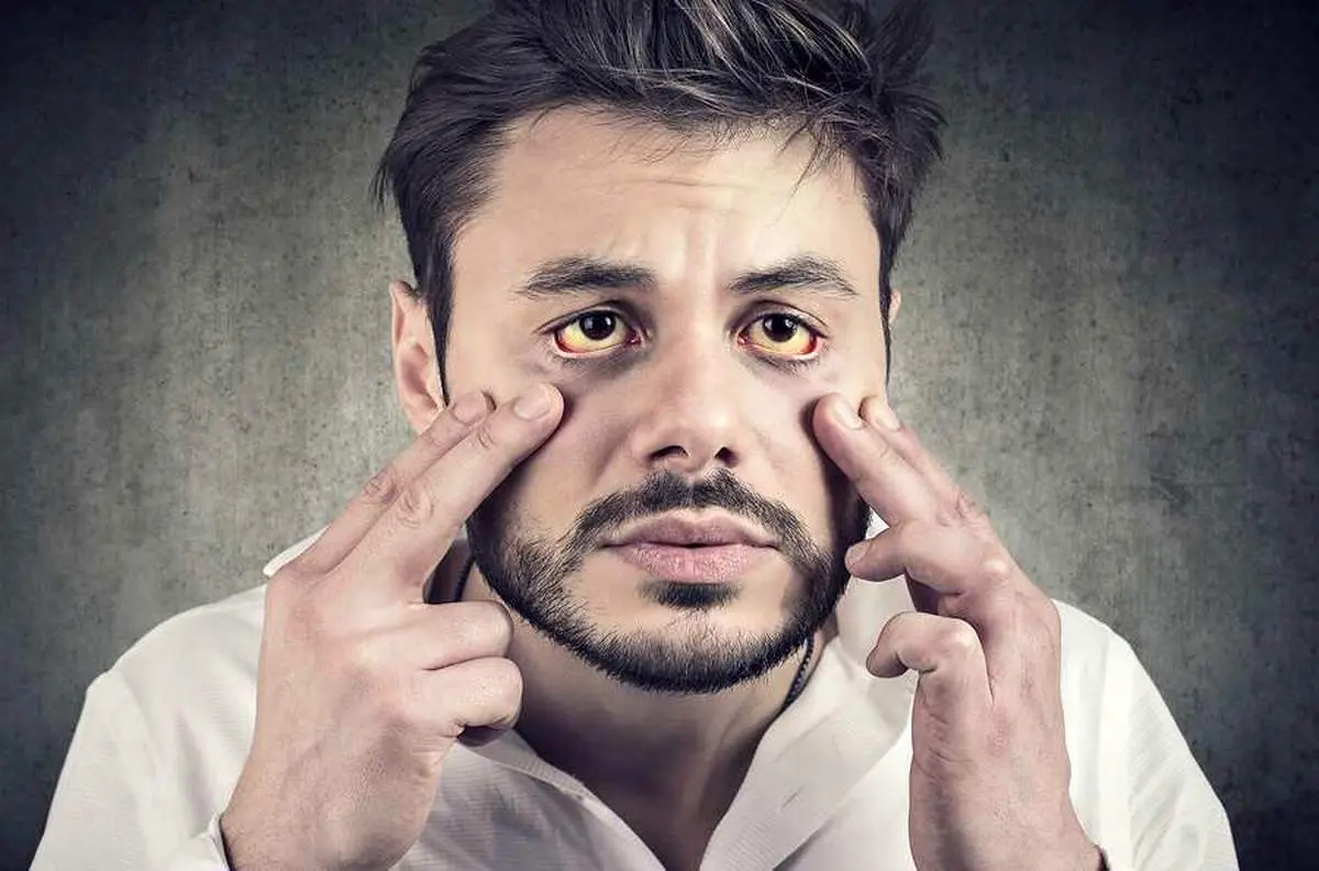 اگر این علائم را دارید سریع به دکتر مراجعه کنید