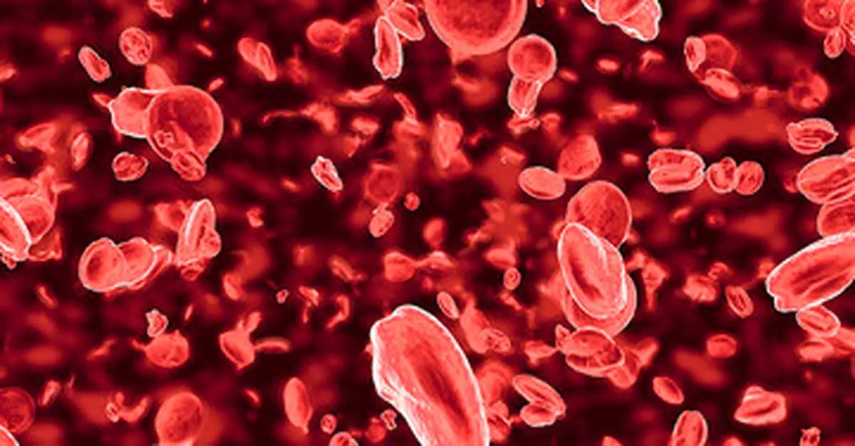 کم خونی دارید؟ این خوراکی ها را بخورید