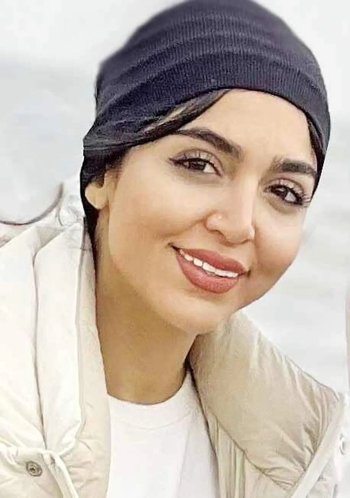 مرگ دلخراش دختر جوان در کیش / اهدای عضو دختر جوان جانی دوباره بخشید