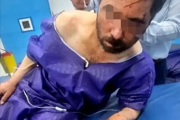 مجروح شدن دامدار جیرفتی بر اثر حمله خرس