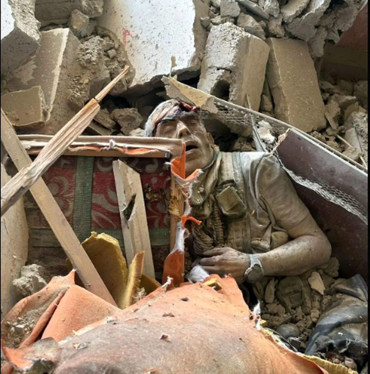 ادعای پزشک اسرائیلی درباره کالبدشکافی پیکر سنوار